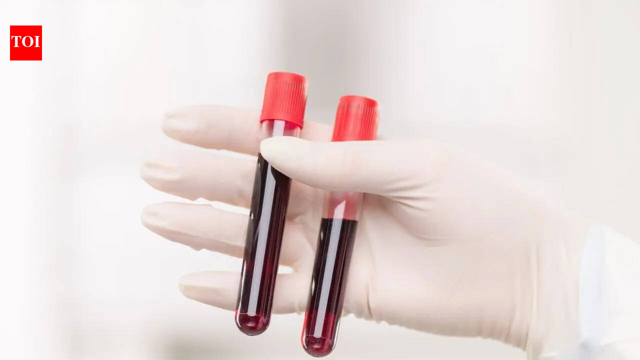 World’s rarest hybrid blood type discovered in Thailand: Study found in just 3 people out of a massive research of 544,000 samples