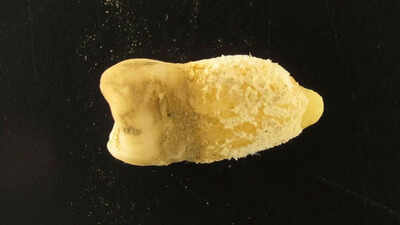 700-year-old Bolivian mummy tooth reveals scarlet fever bacterium before Europeans arrived