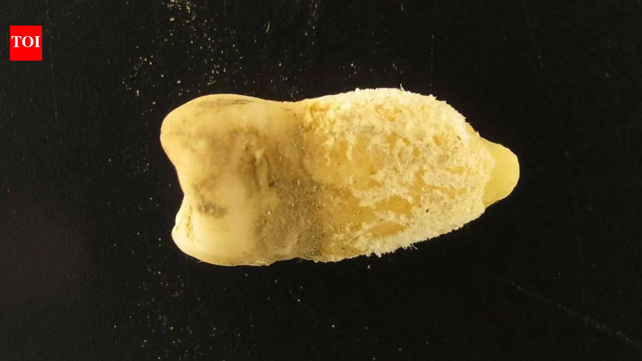 700-year-old Bolivian mummy tooth reveals scarlet fever bacterium before Europeans arrived