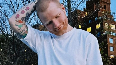 Ed Sheeran reveals shingles diagnosis: What it is and why you should care