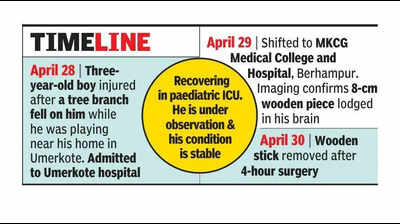 MKCG docs remove 8cm twig from 3-yr-old’s brain