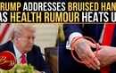 Trump Responds To Health Concerns, Drops 'Very Healthy' Claim As Bruising Sparks Talk