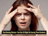Can hair oil clog your pores? The real reason behind forehead acne