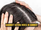 Why your dandruff gets worse in summer: The heat and humidity connection explained