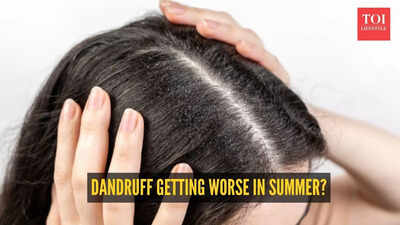 Why your dandruff gets worse in summer: The heat and humidity connection explained