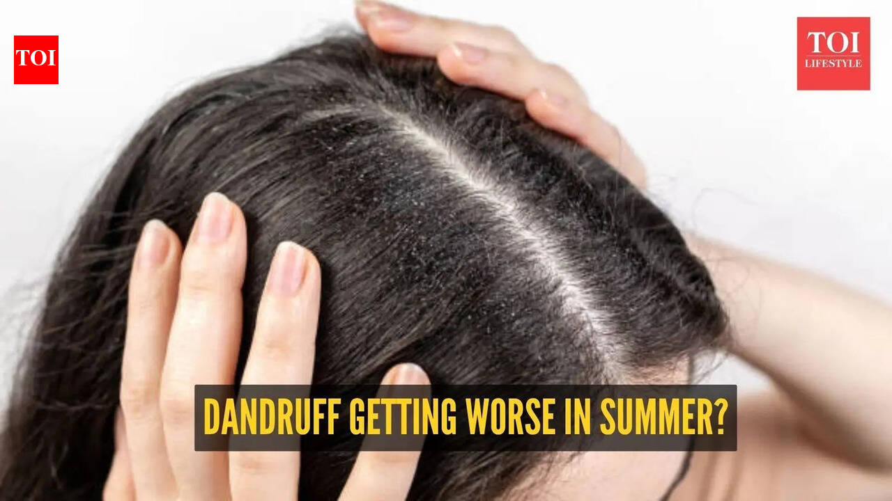 Why your dandruff gets worse in summer: The heat and humidity connection explained