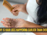 Early hair loss in your 20s & 30s: Why it&rsquo;s happening earlier than ever and what can actually help
