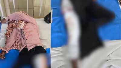 2 accused in Odisha's Belpahar murder case injured in police firing
