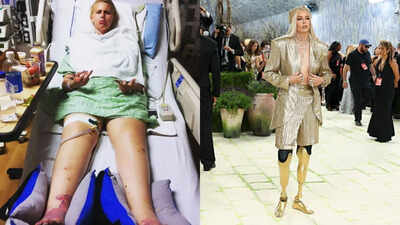  The 'Girl with Golden Legs' who lost both her limbs due to a tampon