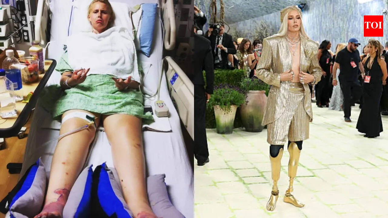 Viral Met Gala Model Lost Her Legs After Wearing A Tampon, Doctors Explain How To Prevent This Extreme Scenario