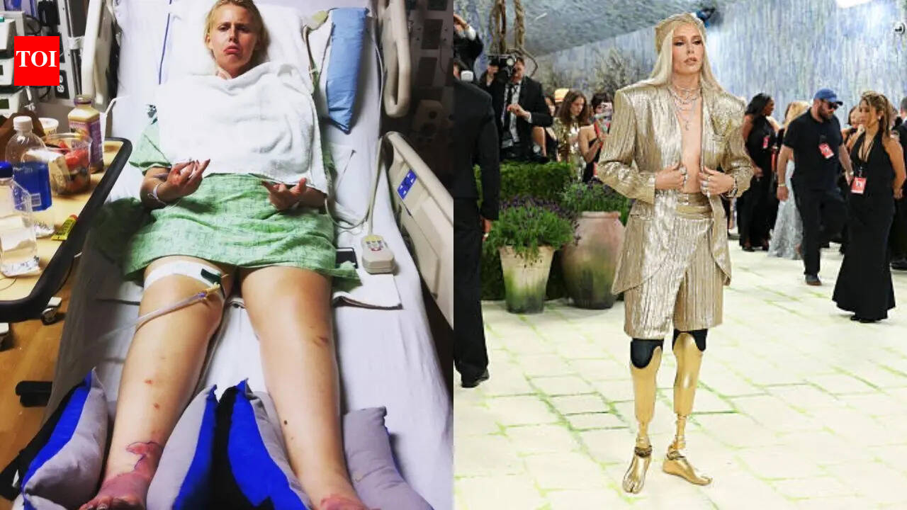 Meet Lauren Wasser: The 'Girl with Golden Legs' who lost both her limbs due to a tampon