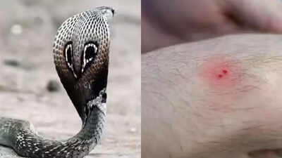 Why rising temperatures are triggering more snakebite incidents across India