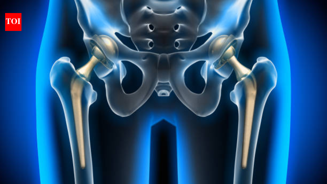 34-year-old man gets back on his feet within 3 hours of minimally invasive (direct anterior) hip replacement