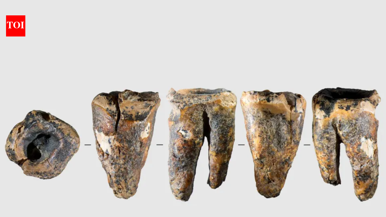 Neanderthal Dental Surgery Found: Study reveals drilled molar and survival; reshapes view of empathy