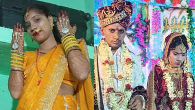 1 year after marriage, woman dies mysteriously; in-laws cremate body before cops arrive