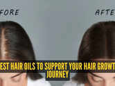 5 oils you need to buy on your hair growth journey