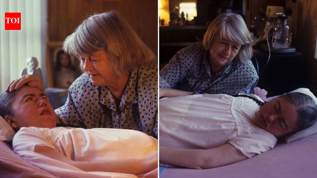 “America’s sleeping snow white”: The world’s longest coma that kept a teen asleep for 42 years until the final goodbye