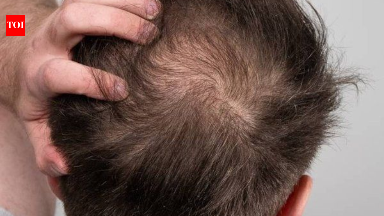 'Hair loss impacted my self-esteem': LeT terrorist says he went for transplant in India