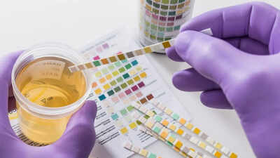 The body check: Your urine colour could be warning you about hidden health problems, what every shade really means