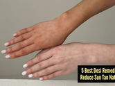 5 desi home remedies to remove stubborn tan fast