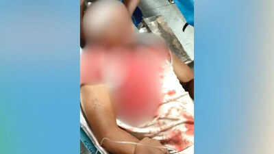 BJP leader Pappu Sana assaulted with bamboo sticks in Bengal; critical