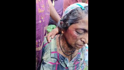 Elephant attack injures woman near Siddapur