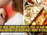 Hotpot meal turns into hospital visit: 42-year-old woman suffers 8 cm oesophagus injury in China