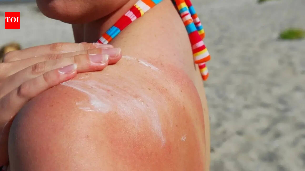 Melanoma skin cancer cases in UK hit record high: Early signs, risk factors, how to spot it before it’s too late