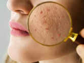 Dark spots, pigmentation, uneven skin tone? Treatments that deliver visible results against sun damage
