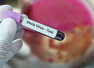 ​Ebola in Europe? Italy reports 2 suspected cases in Milan &mdash; How travelers can protect themselves from infection​