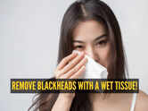 How to remove blackheads with a wet tissue