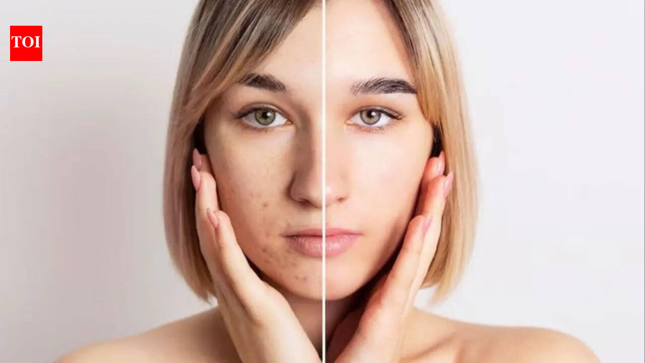 Skincare solutions for pigmentation and uneven skin tone: One step you’re probably skipping