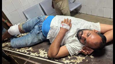 Criminal injured in police firing on city outskirts