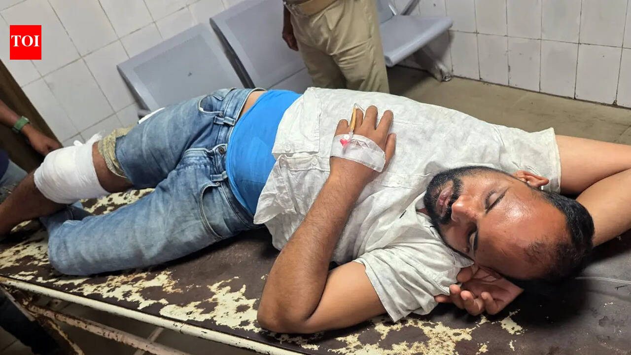 Criminal injured in police firing on city outskirts
