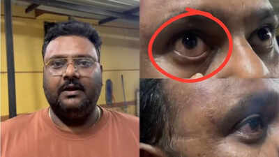 Pune techie, family attacked after bike brushes against MUV