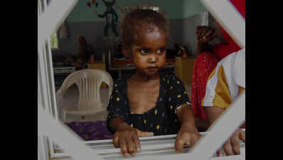 22.1% of state kids under 5 years suffer from acute malnutrition: NFHS-6