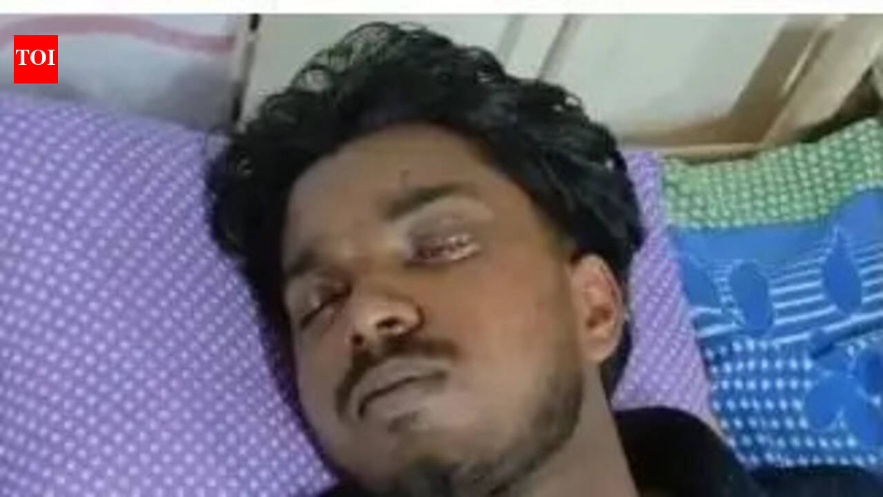 BTech student loses vision in assault