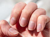 The body check: What your fingernails may reveal about health