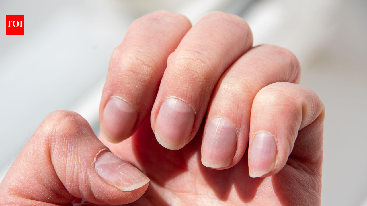 The body check: What your fingernails may reveal about health