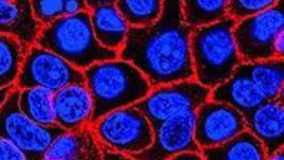 Experimental pill promises new hope for deadly pancreatic cancer