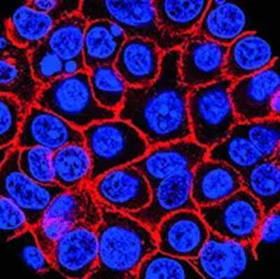 Experimental pill promises new hope for deadly pancreatic cancer