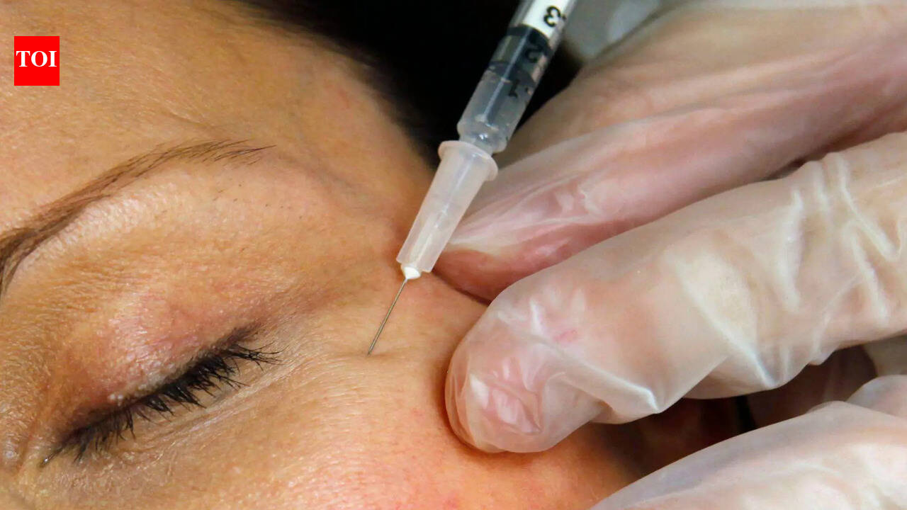 In 1987, doctors observed wrinkle changes in eye patients, marking Botox’s entry into cosmetic use