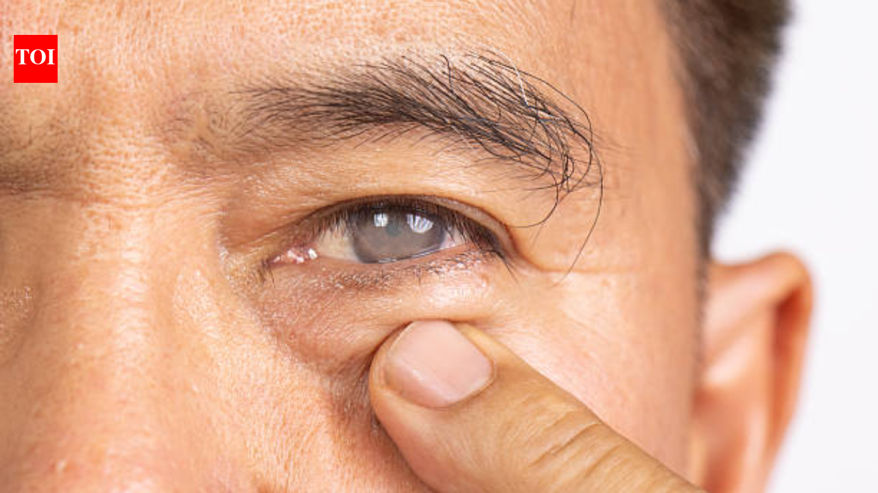 The first thing cataracts steal isn't vision: The subtle changes many people dismiss for years