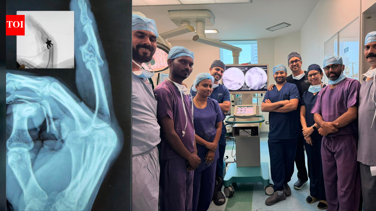 Doctors perform finger joint replacement surgery on 46-year-old man, restore hand function after devastating accident