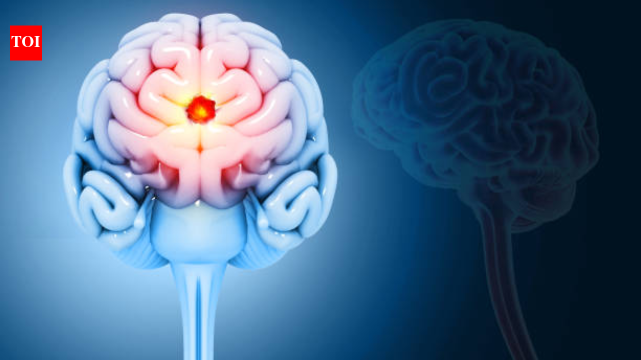 The first signs of a brain tumour are often mistaken for stress, migraine, or burnout: Here's what to watch for