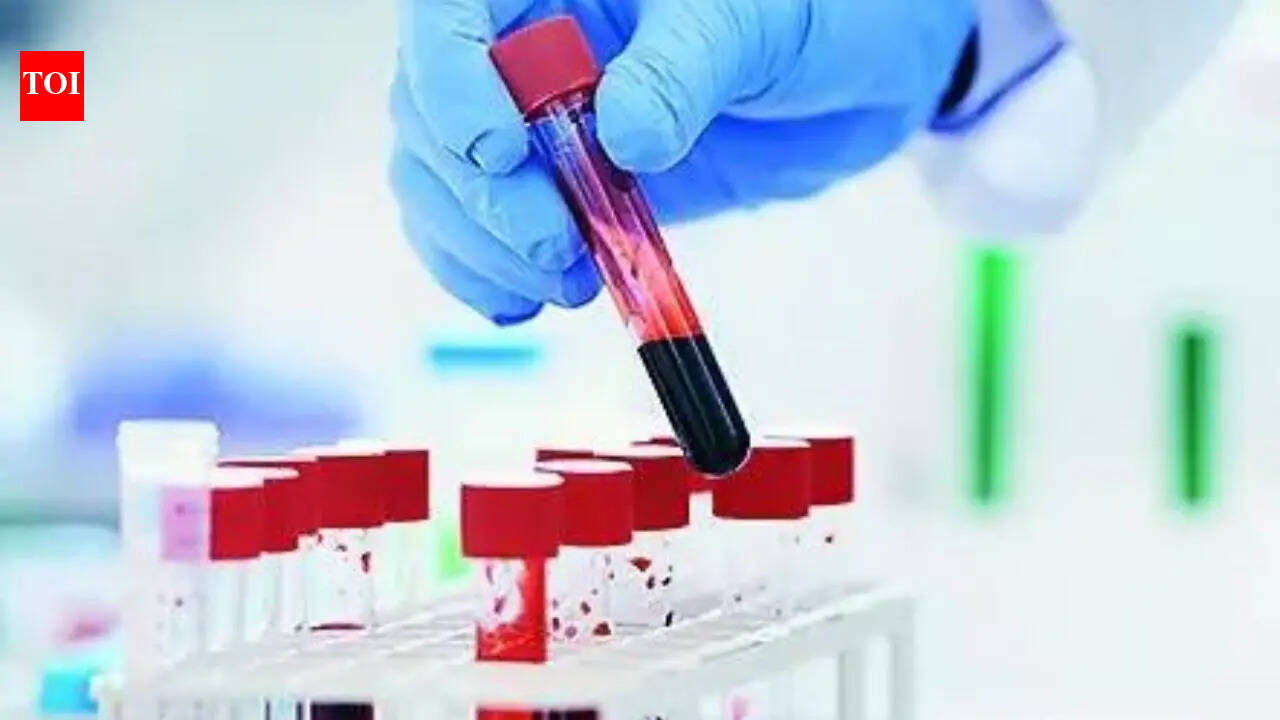 Blood test can predict lung cancer 5 years before diagnosis