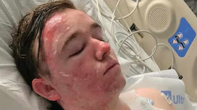 McDonald’s worker left in ICU after colleague throws scalding oil on him, mother launches fundraiser: 'The pain he’s experiencing...'