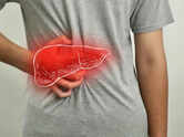 Fatty liver disease: How an NHS surgeon reversed it