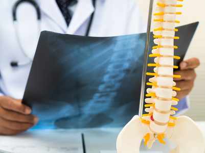 35-year-old walks same day after rare triple motion-preserving spine surgery