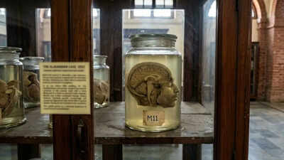 A head in a jar for 74 years: As another beheading case shocks Chennai, experts recall Alavandar murder